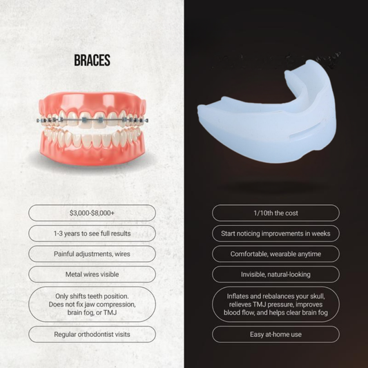 ChewSmart Mouthguard Pro
