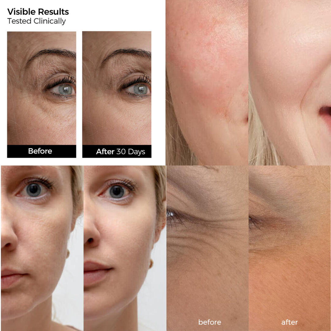 Oil-Suspension Serum