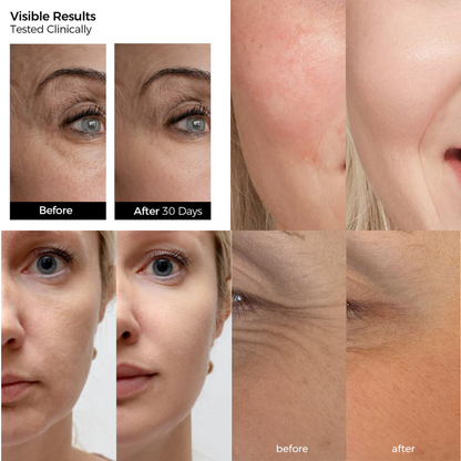 Oil-Suspension Serum