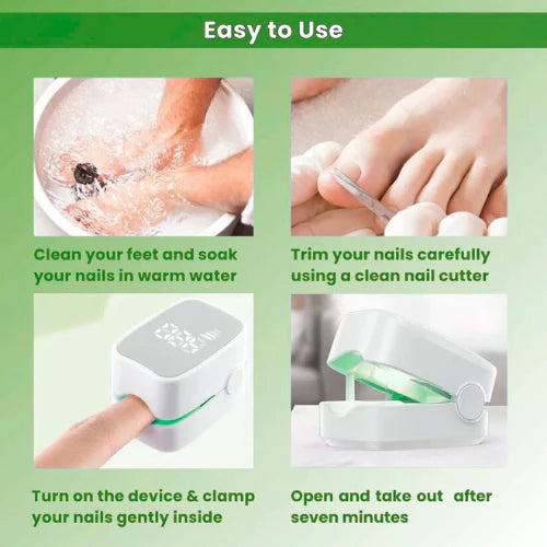 Fungiclear- Nail Fungus Laser