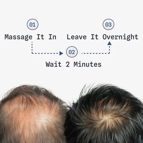 Stem Cell Hair Restoration