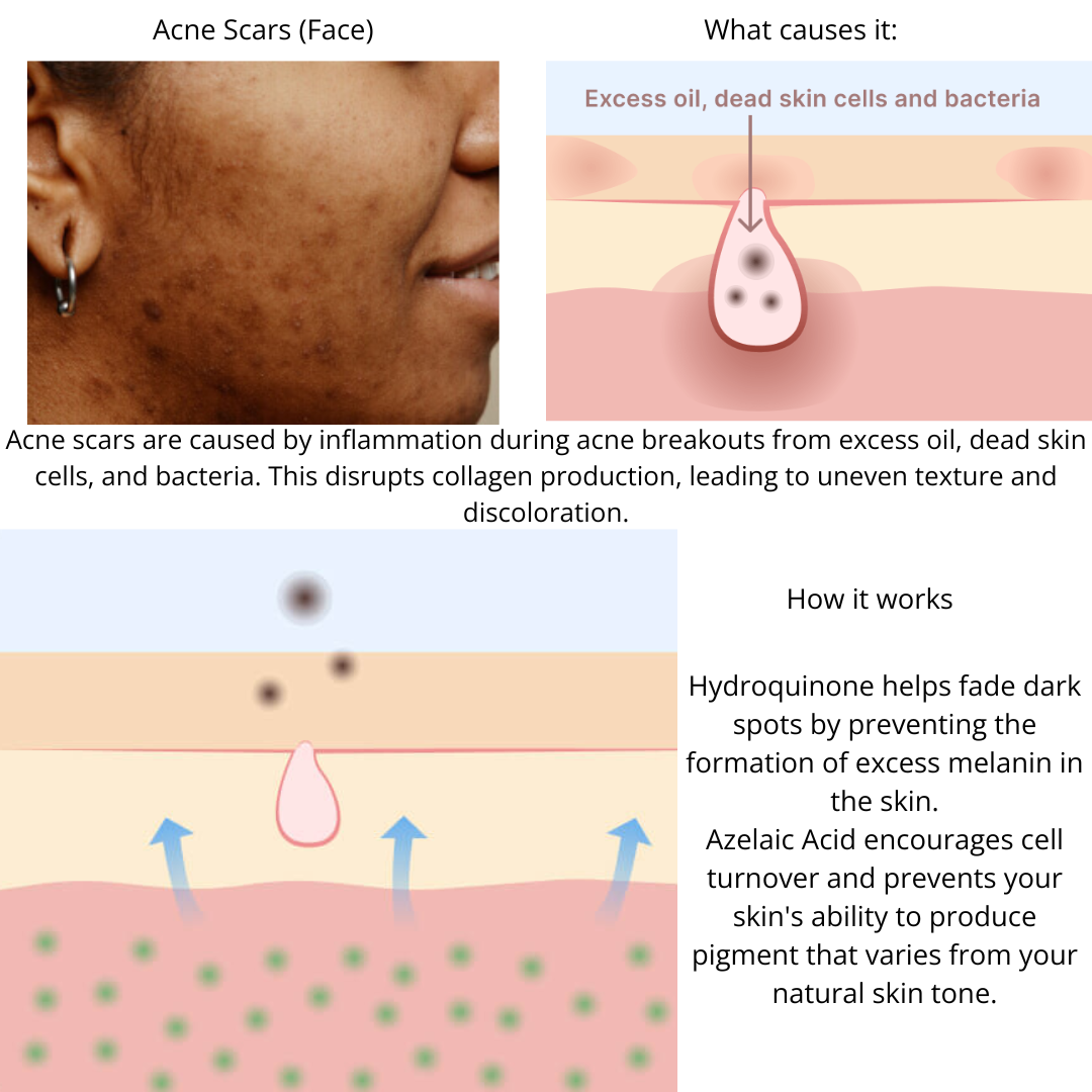 Muselee The Spot Cream