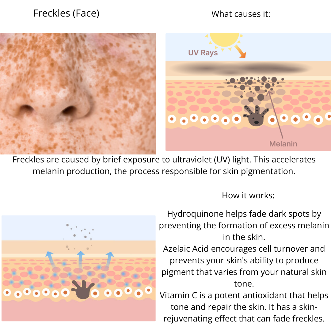 Muselee The Spot Cream