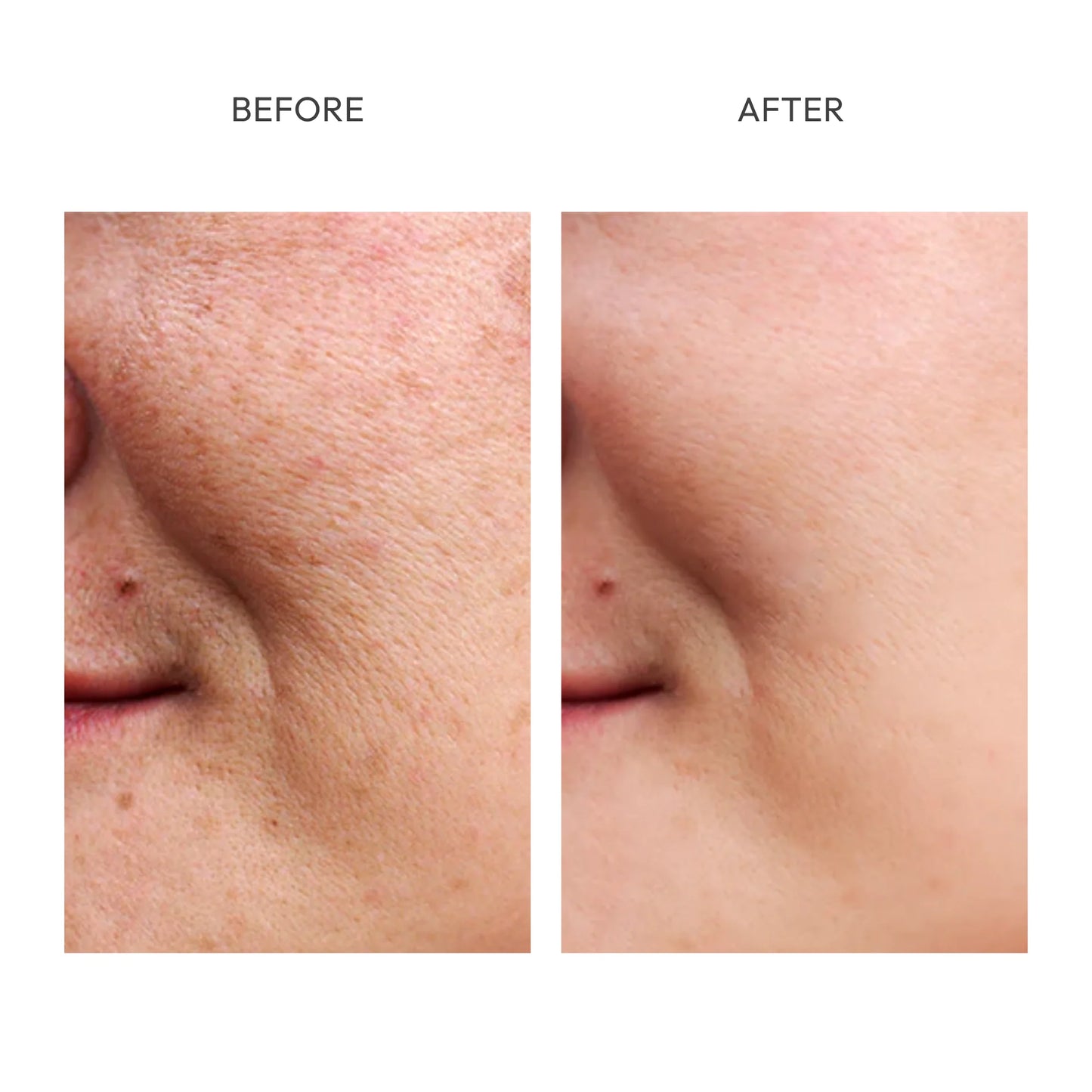 Fadeon-Dark Spot Corrector