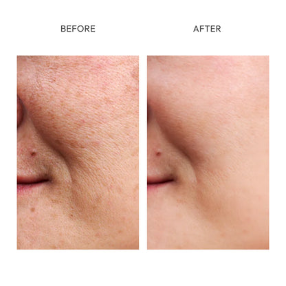 Fadeon-Dark Spot Corrector