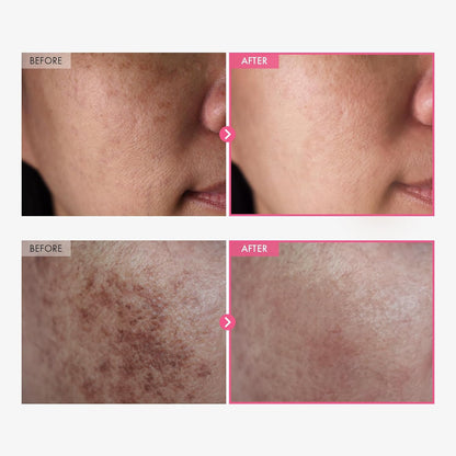 Arbutin Brightening Cream