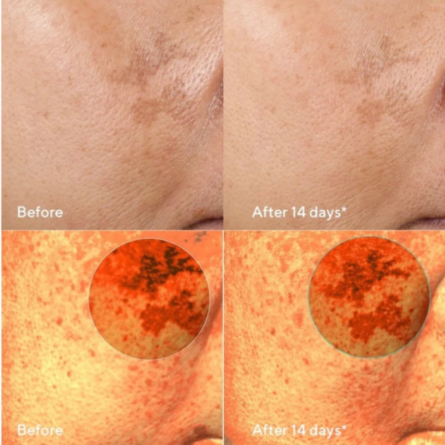 Fadeon-Dark Spot Corrector