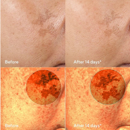 Fadeon-Dark Spot Corrector