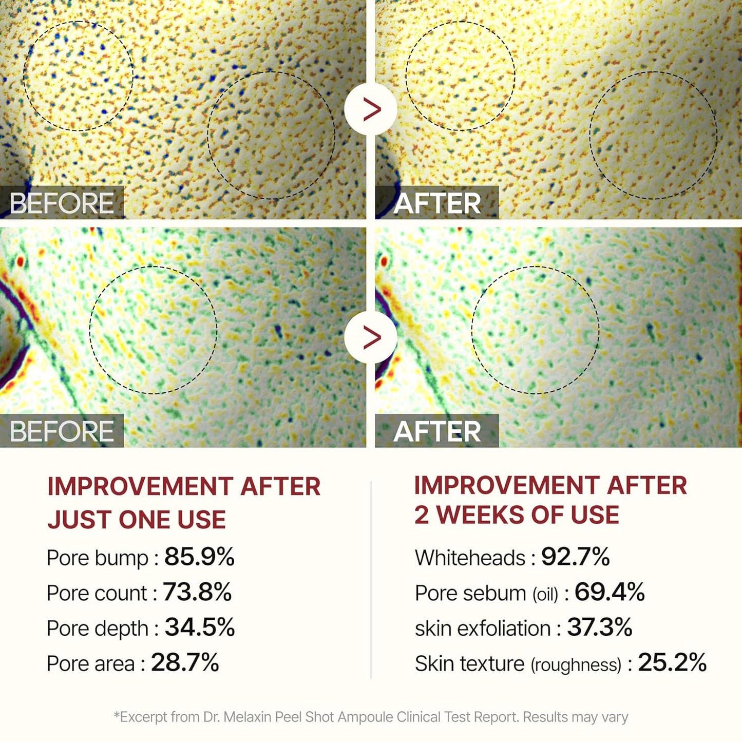 Peel Shot Glow Rice Ampoule Duo