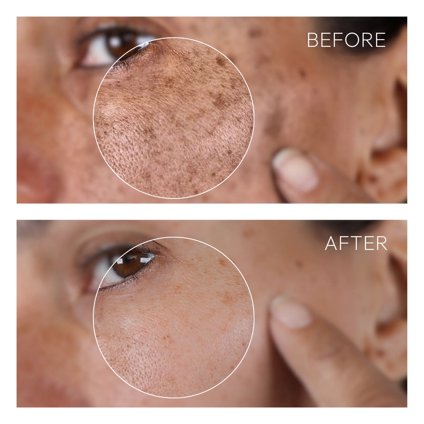 Fadeon-Dark Spot Corrector