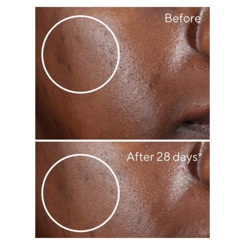 Fadeon-Dark Spot Corrector