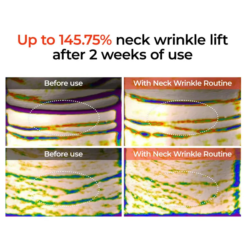 NeckLift Linefill Cream