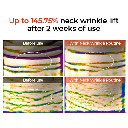 NeckLift Linefill Cream