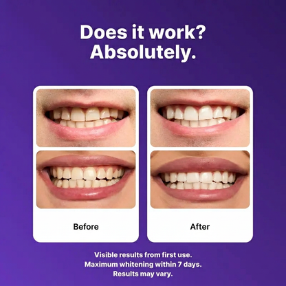 Purple Teeth Whitening Strips