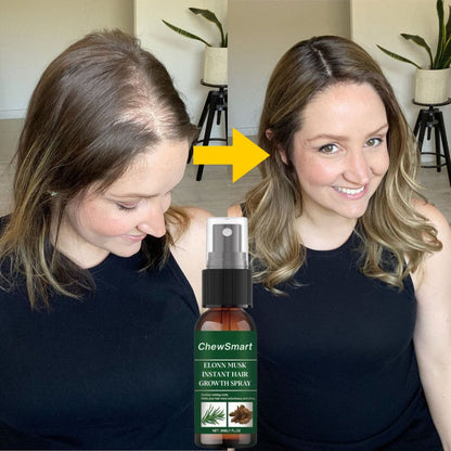Elonn Musk instant hair growth spray